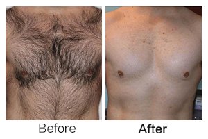 befor and after